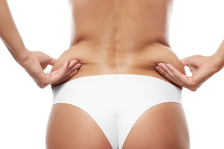 lipoaspiration