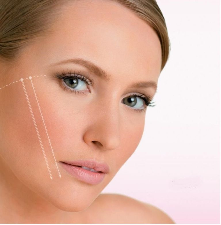 Fils Tenseurs pour le Visage
