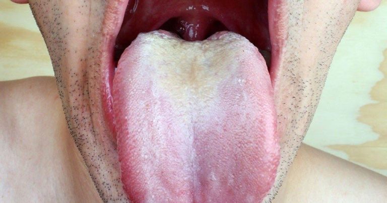 Goût Amer dans la Bouche