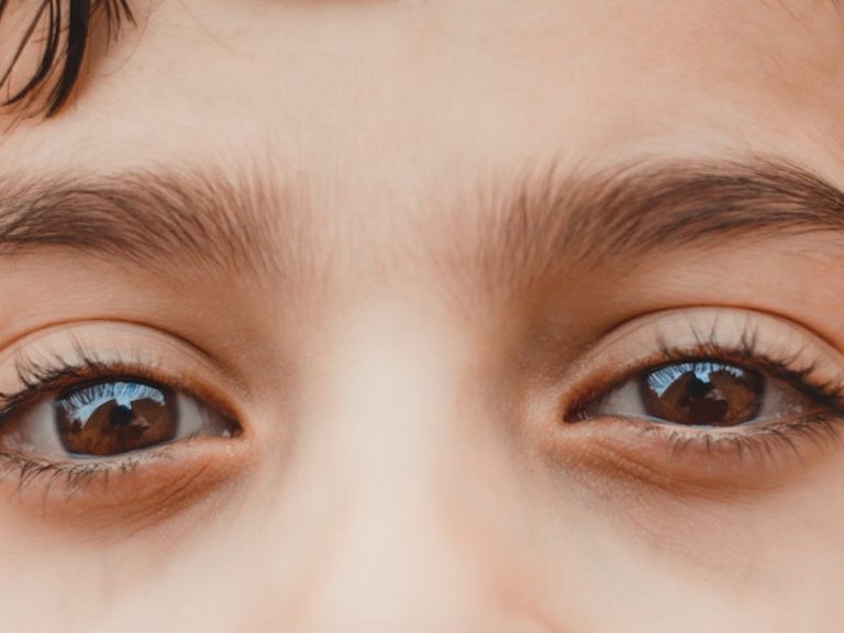 Yeux Vitreux