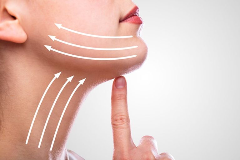 Lifting Cervico-facial