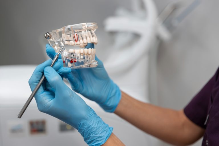 prix implant dentaire