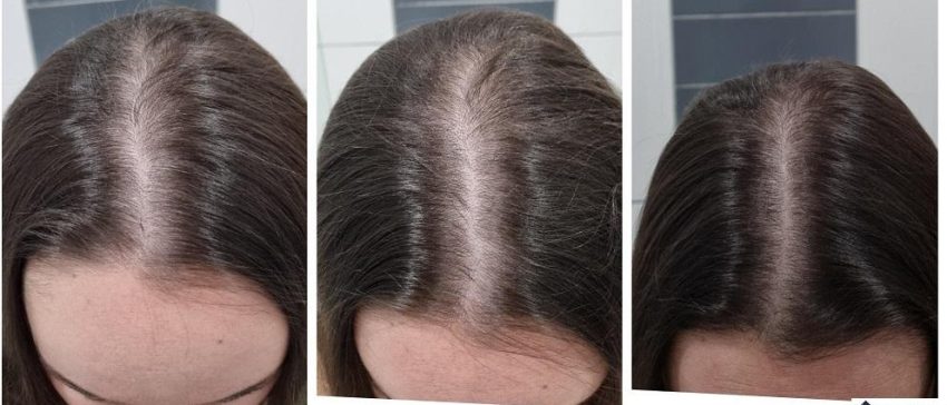 Sérum à La Biotine Et Vitamine E Pour Cheveux - Croissance Plus Rapide Et Super Longueur