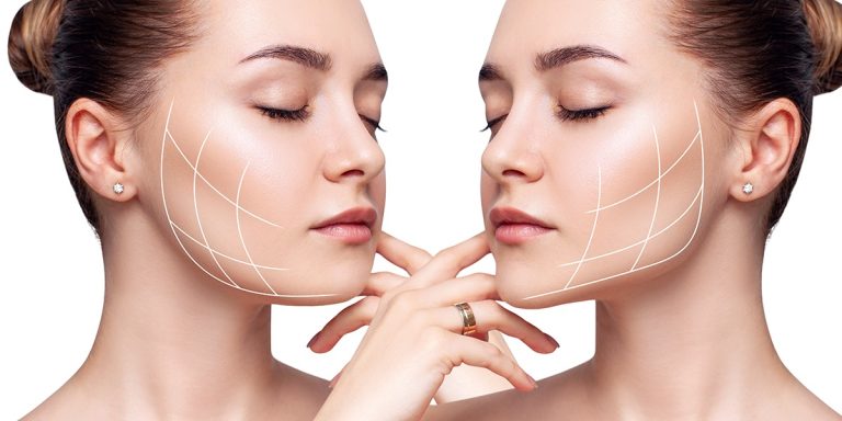 liposuccion-visage-prix