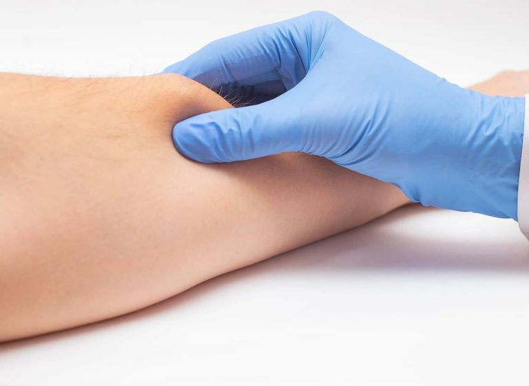 tarif-pour-enlever-un-lipome
