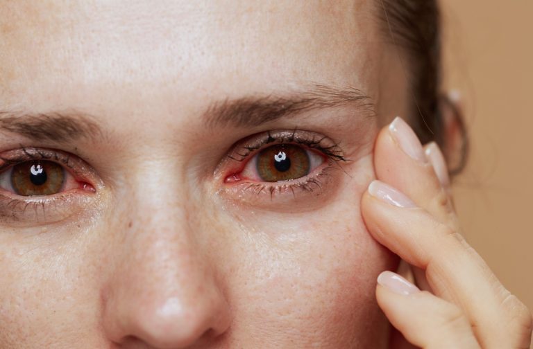 complement-alimentaire-pour-secheresse-oculaire