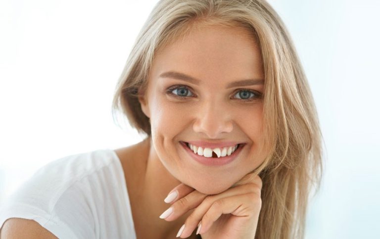 dent-cassee-que-faire-en-attendant-le-dentiste