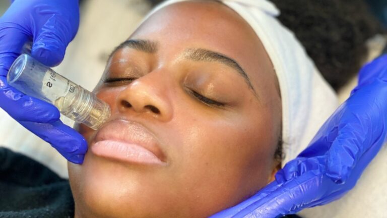 mesotherapie
