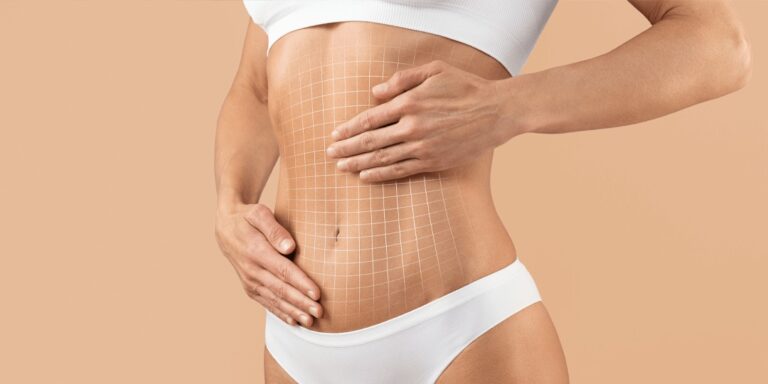 abdominoplastie-prix