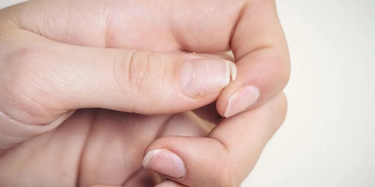 ongles-qui-se-dedoublent