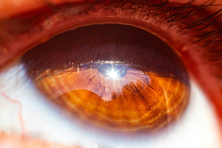 changements de vision surprenants après la chirurgie de la cataracte
