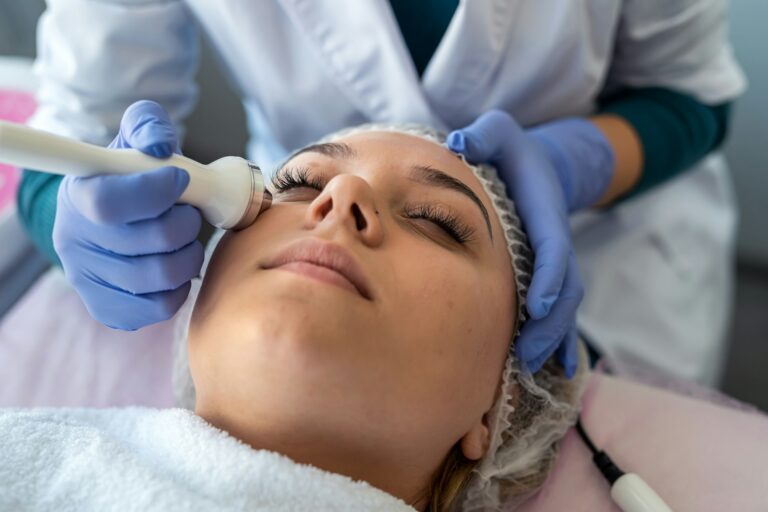 microneedling-cernes-avis