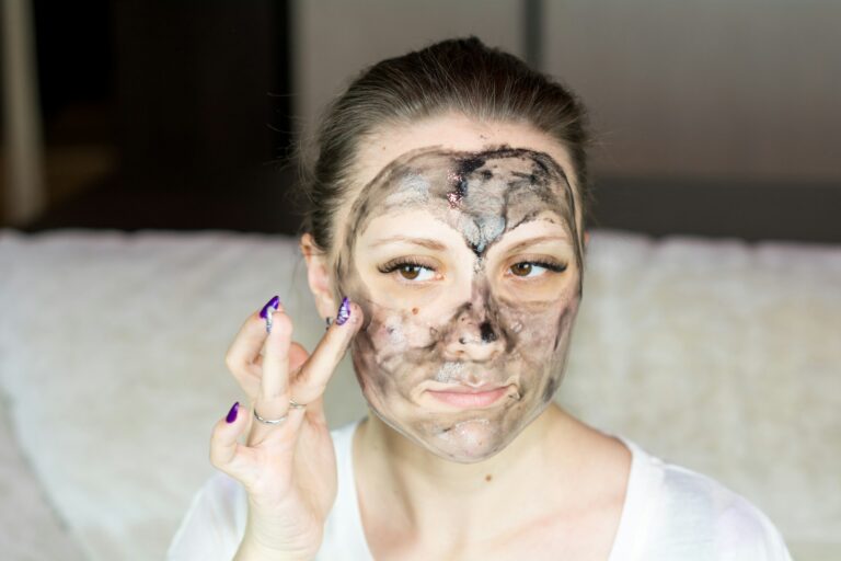 peeling-acne