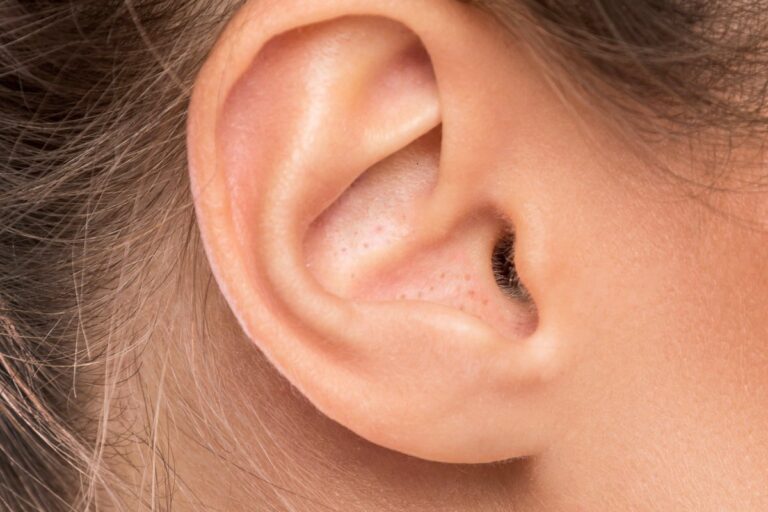 point-noir-oreille