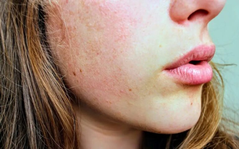 vaisseau-eclate-visage-que-faire
