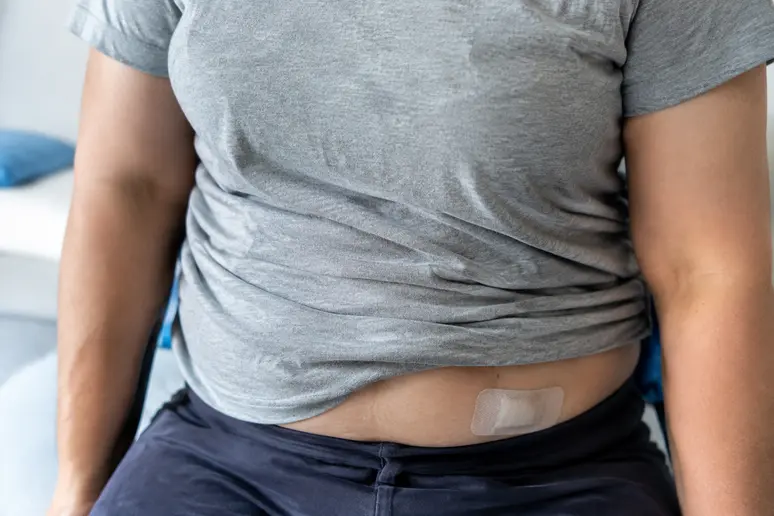 Ventre d'une personne habillée montrant la zone ombilicale en période de convalescence post-opératoire